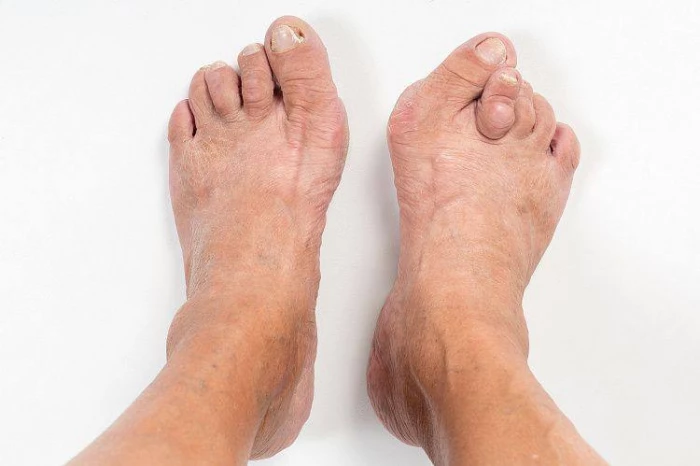 «Правильная» и «неправильная» обувь – почему важно сделать верный выбор