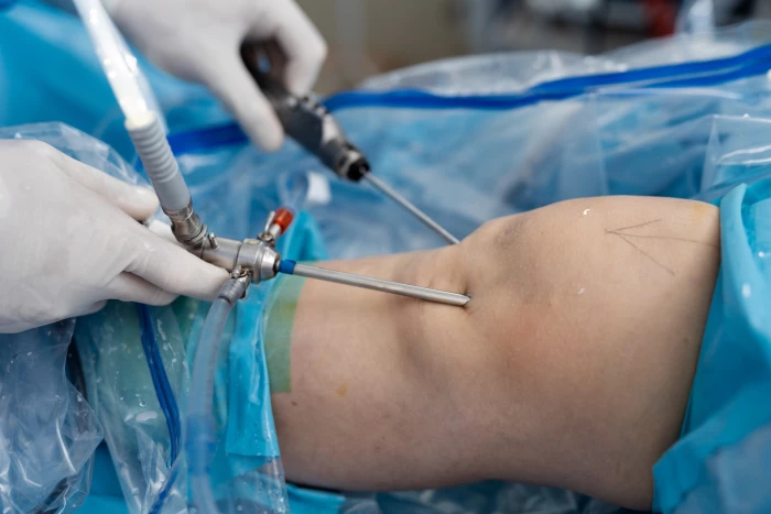 Артроскопия: что следует знать?